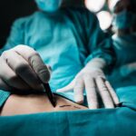 image-close-up-of-a-plastic-surgeon-marking-the-human-skin-for-surgery