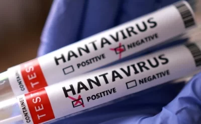 AB hantavirusa qarşı peyvənd və müalicə üsulları üzərində işləyir.