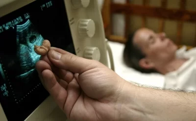Ölkədə abortların sayı sürətlə artır
