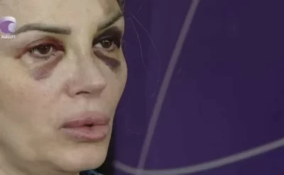 Mağazada döyülən qadın danışdı: “Demişdi ki, səni doğrayacağam”