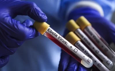 Konqoda Ebola qurbanlarının sayı 1405-ə çatdı
