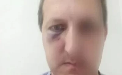 Xalq artistinin oğlunu döyməyə görə daha 2 şəxs