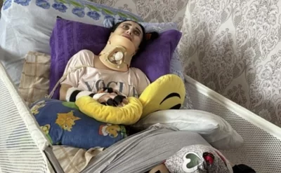 Bakıda rinoplastika əməliyyatından sonra iflic olan 34 yaşlı qadın öldü - Foto