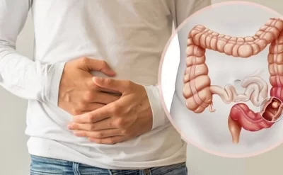 Həkimdən bağırsaq xərçəngi ilə bağlı xəbərdarlıq –