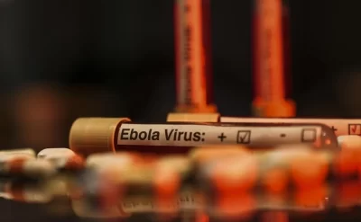 Konqo Demokratik Respublikasında Ebola halları 7 404-ə çatıb