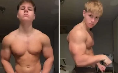 Steroid qəbul edən gəncin son halı gündəm oldu -