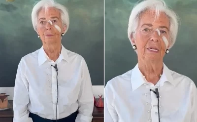 Lagardın üzündəki sarğıların səbəbi məlum oldu: