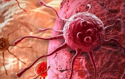 Uşaqlarda onkoloji xəstəliklər artır: “Risk faktorları çoxalıb”