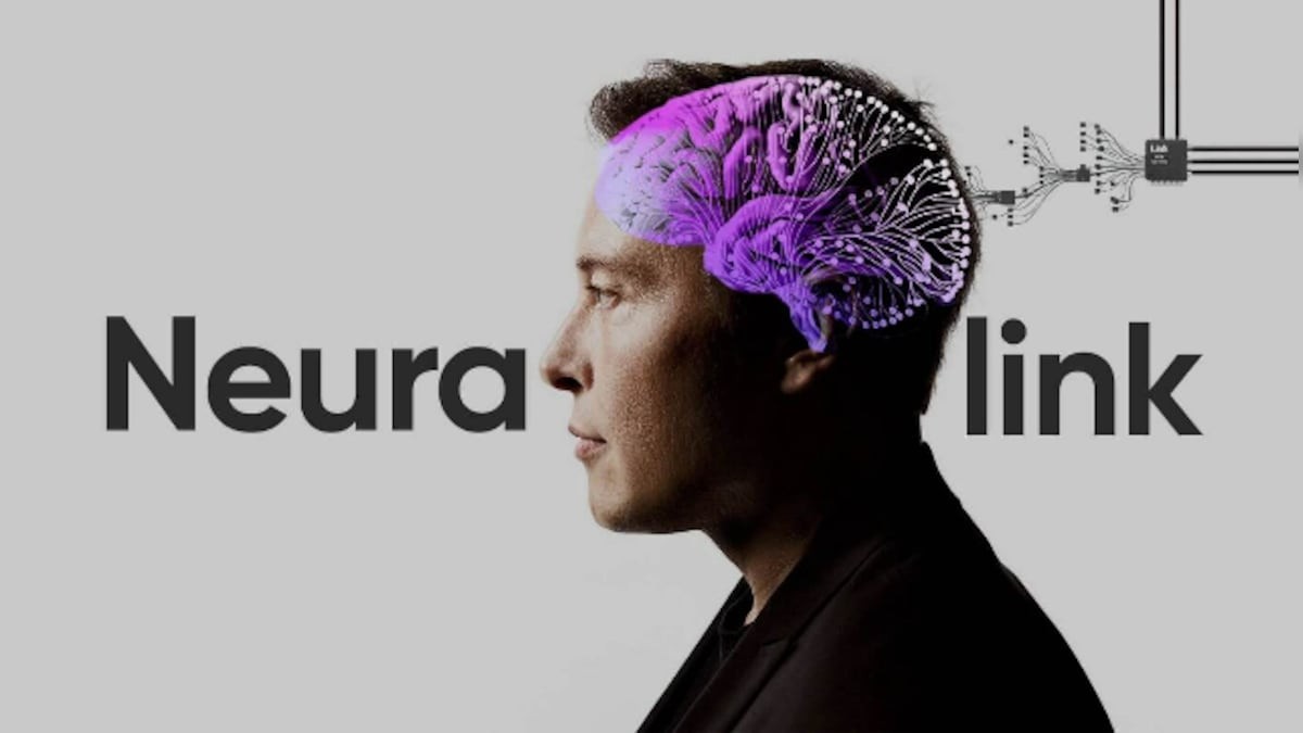 “Neuralink”dən inqilabi texnologiya: İnsan düşüncələri səsə çevriləcək  