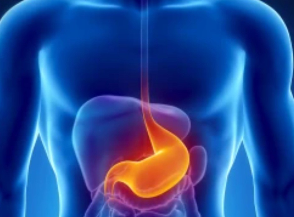 Mədə yırtığı nədir: Simptomları və müalicəsi 