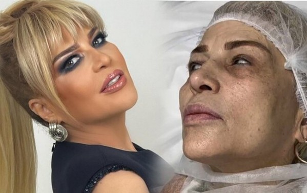 Mətanət İsgəndərli tanınmaz halda – VİDEO