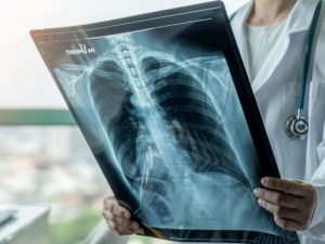 image-7bd4b17e95fe269621192220814f23bb