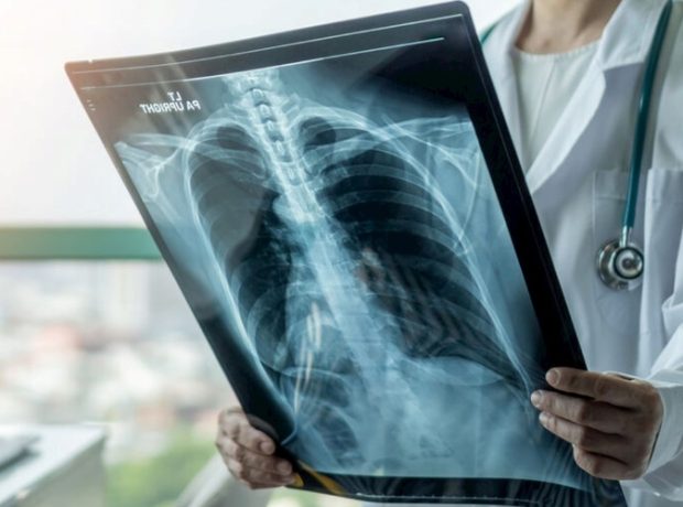 image-7bd4b17e95fe269621192220814f23bb